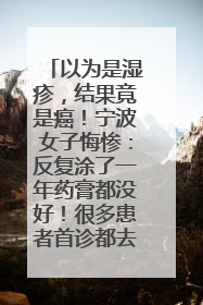 以为是湿疹，结果竟是癌！宁波女子悔惨：反复涂了一年药膏都没好！很多患者首诊都去了皮肤科
